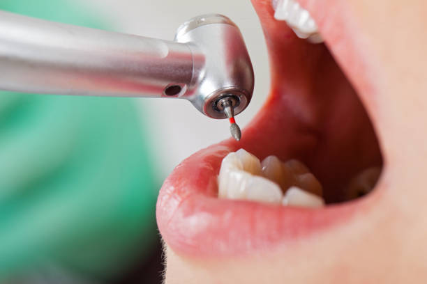 Best Emergency Dental Care for Broken or Chipped Teeth in Ak Chin Village, AZ